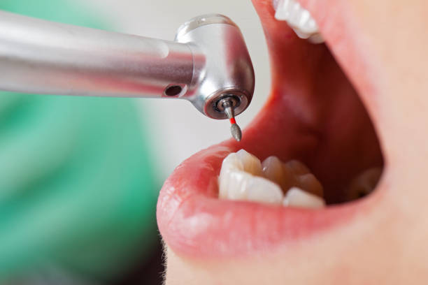 Best Urgent Dental Care for Toothache in Mountain Home, ID